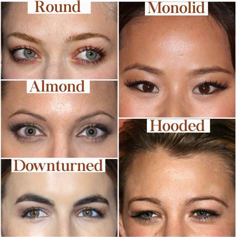 Eyelid droop usually resulted from blocking the elevator muscle when the injection was placed very close to the eyebrow and the product migrated down into the upper eyelid elevator. . Hooded eyes heavy eyebrows after botox